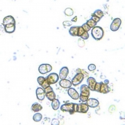 4. spore gljive S.polyspora 2